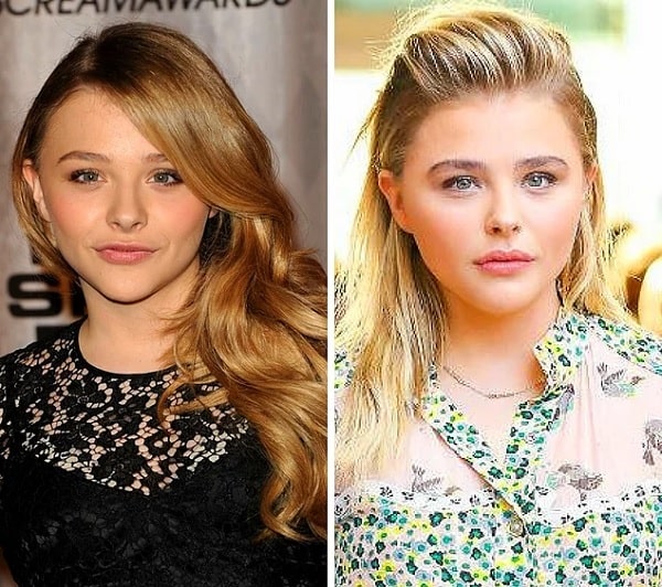 A picture of Chloe Grace Moretz before (left) and after (right).